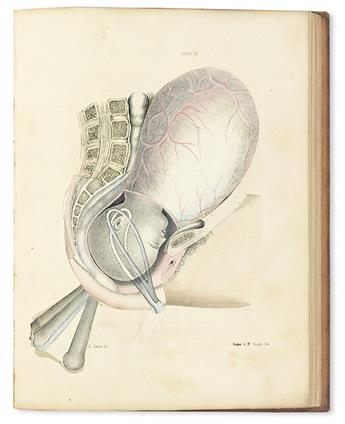 SPRATT, GEORGE. Obstetric Tables.  1850